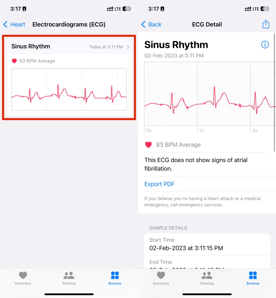 How to Use Apple Watch ECG